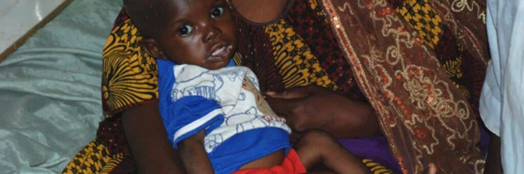 Crise de la malnutrition au Mali : enjeux et solutions en santé publique