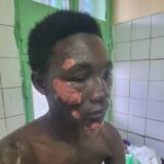 Tchad : un père interpelle les autorités après l&rsquo;agression près du camp 27