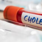 Épidémie de choléra au Tchad : 13 morts et 239 cas confirmés, campagne de vaccination en cours
